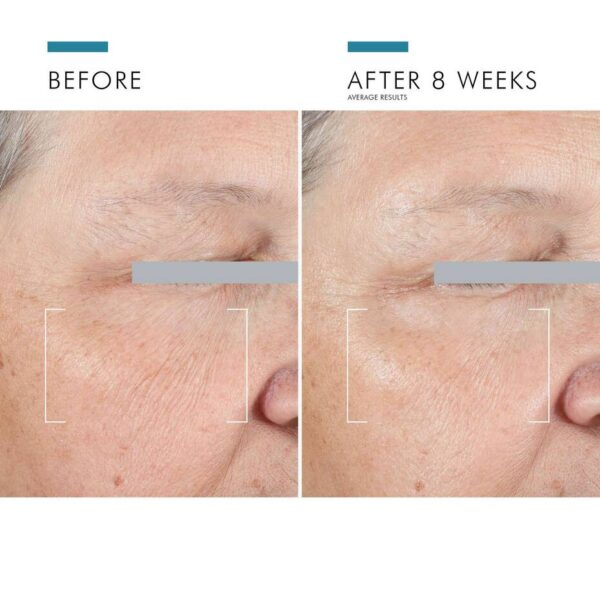 A.G.E. Advanced Eye for Dark Circles - Image 8