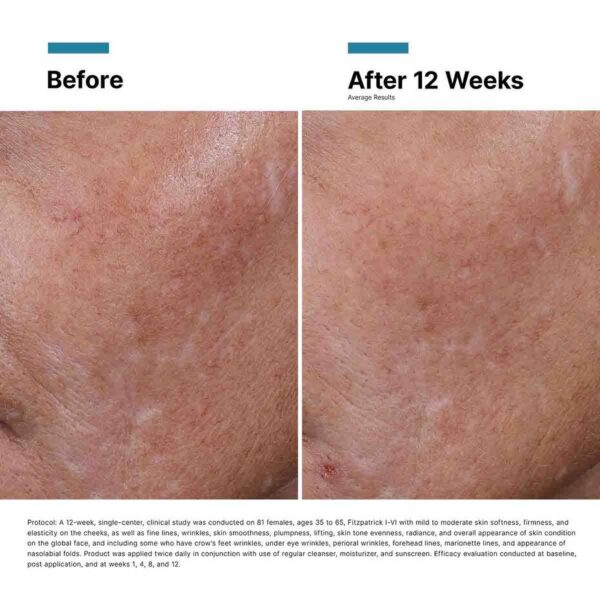 Hyaluronic Acid Intensifier Multi-Glycan - Image 13